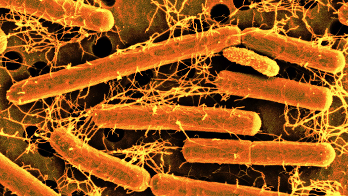 Mikroskopische Aufnahme eines Lactobacillus acidophilus