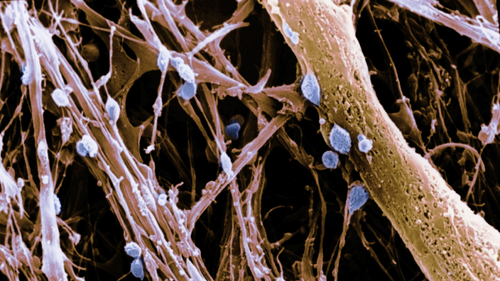 Elektronenmikroskopaufnahme des Hypothalamus mit Parenchymen und Neuronen